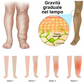 👑👑𝗩𝗡𝗣𝗥𝗢𝗢® Supporto termico per il ginocchio a radiofrequenza a base di erbe